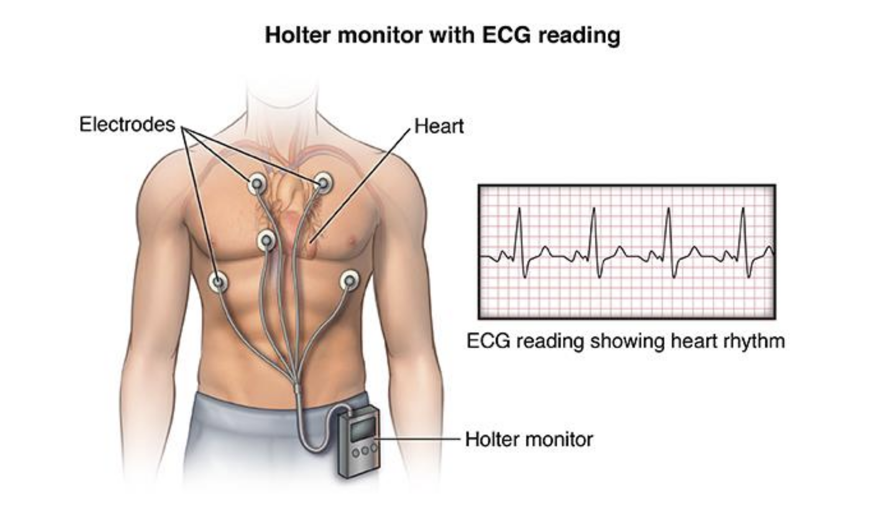 Holter Image