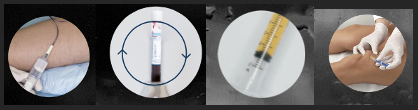 PRP 1