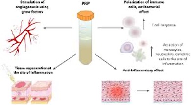 prp 7